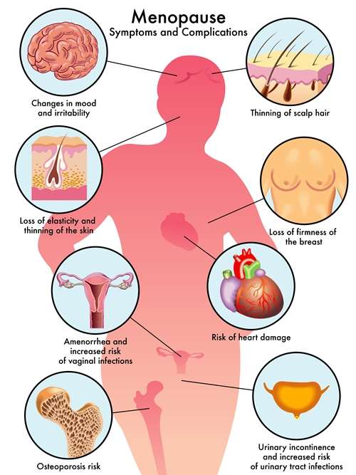 Menopause picture